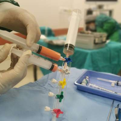Stem cell transplant